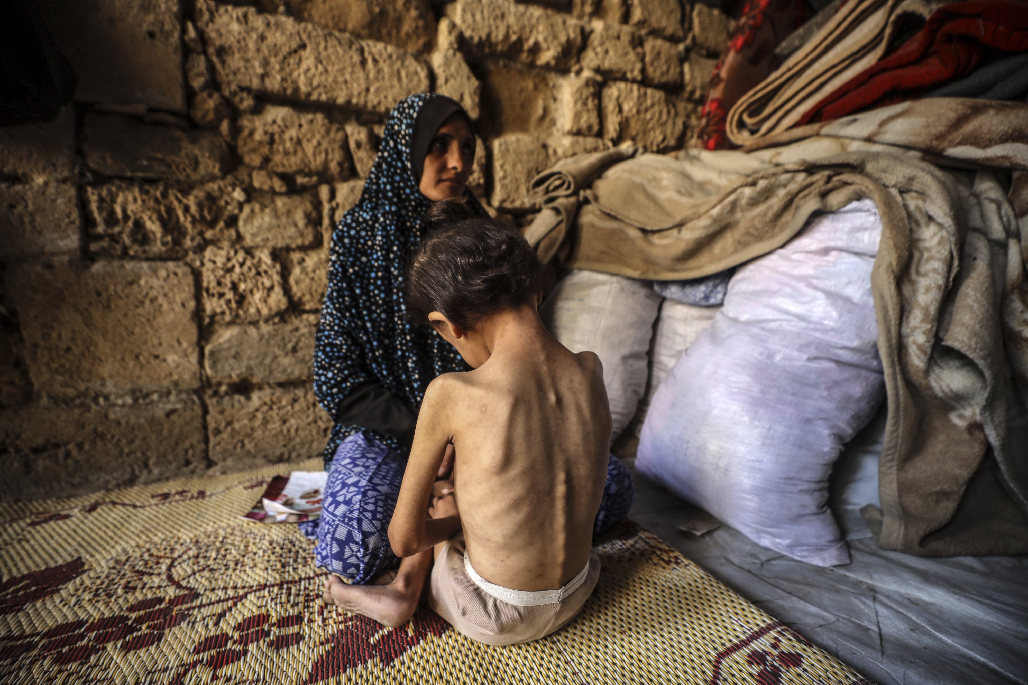 A woman consoles her 6-year-old daughter, who is malnourished, at a shelter in central Gaza City, on May 11, 2025.