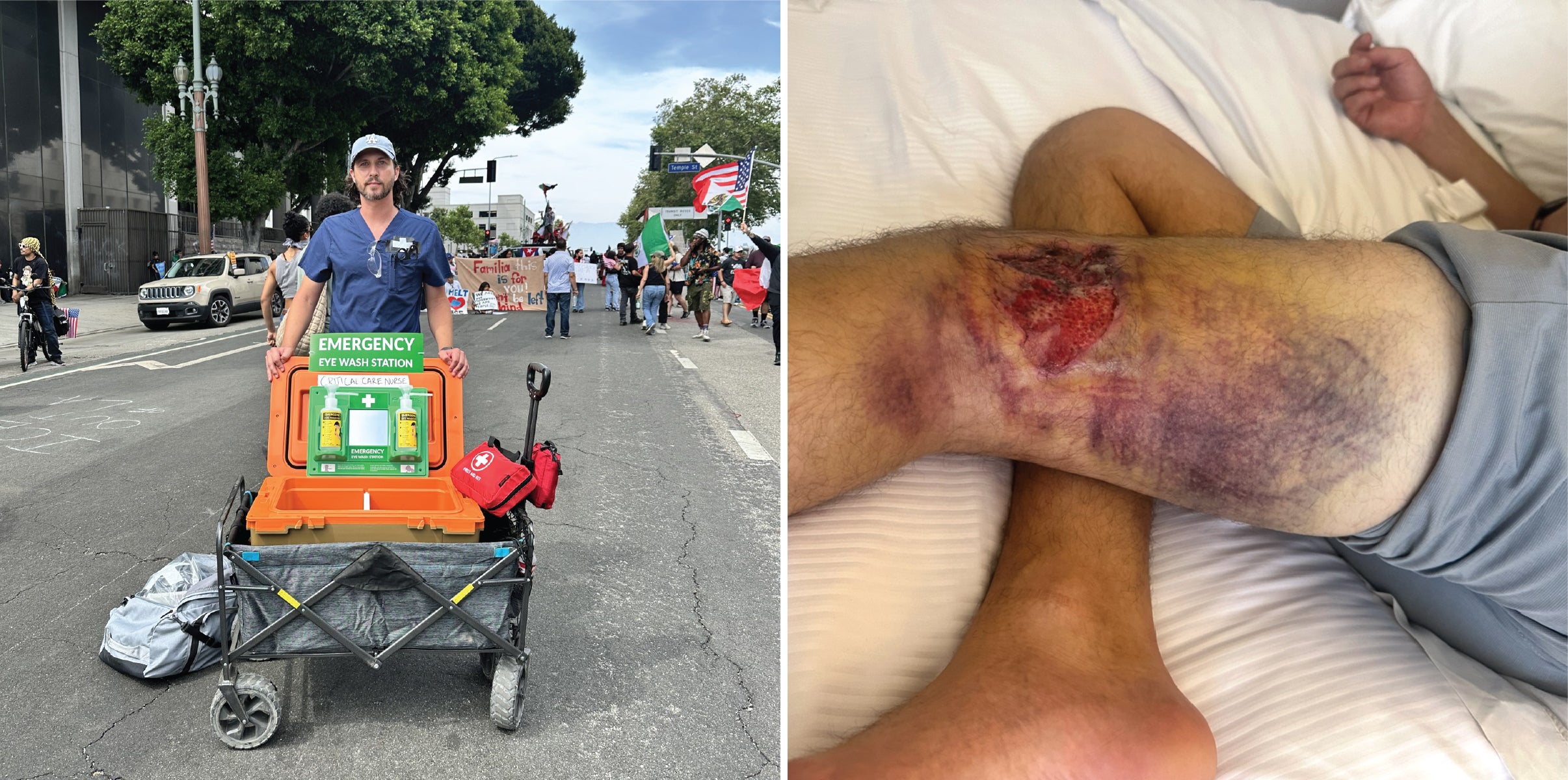 Photo of man standing in a street and a wound on a leg