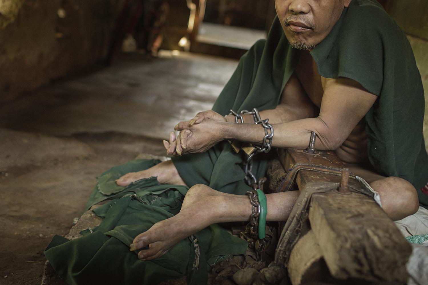 This man lived shackled in stocks, a traditional form of pasung, for nine years in a back room in his family’s home in Cianjur in West Java. When he was released, his legs had atrophied from disuse.