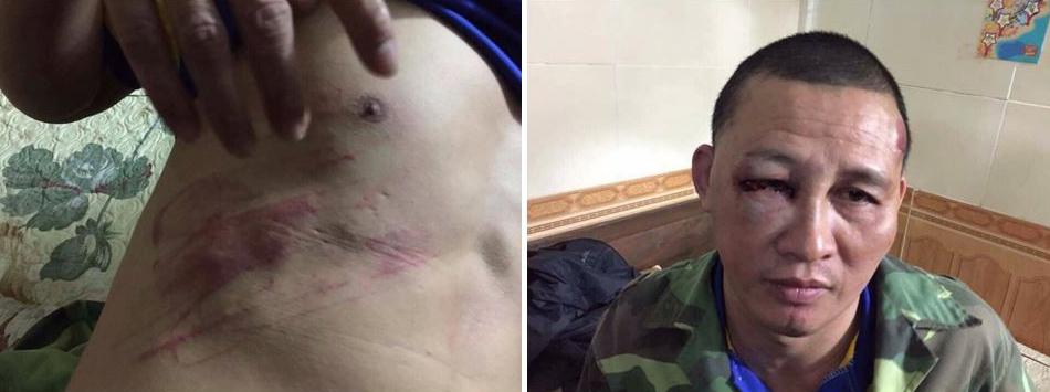 Nguyen Cong Huan after being assaulted in Nghe An on December 2, 2016.