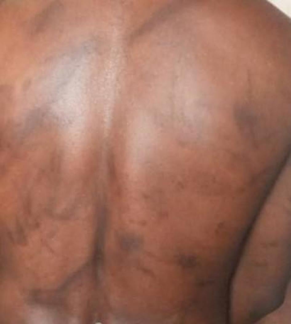 A suspected armed separatist, 46, said he was tortured at the State Defense Secretariat (SED) in Yaoundé, Cameroon, where he was held for six months in 2018.