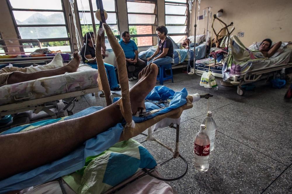 Artefactos improvisados por médicos, usando botellas de refresco y bidones de agua reciclados como pesas, para tratar a pacientes con fracturas en las piernas en el Hospital Universitario Dr. Luis Razetti en Barcelona, 15 de abril de 2016. 