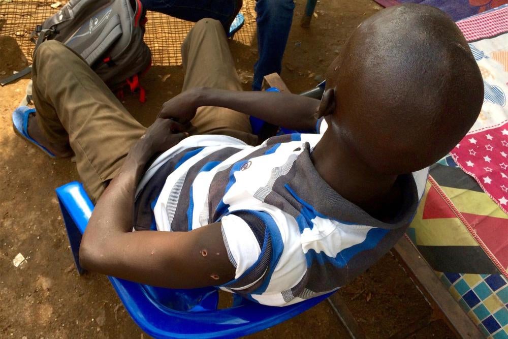 رجل من قبائل النوير، أطلق جنود الحكومة النار عليه 7 مرات عند نقطة تفتيش مؤقتة قرب جامعة جوبا في 8 يوليو/تموز، 2016.