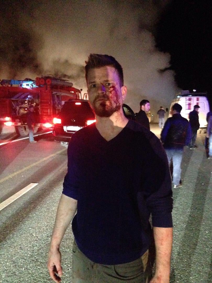 Пострадавший корреспондент норвежской газеты Ny Tid Ойстейн Виндстад после нападения на автобус с журналистами. Орджоникидзевская, март 2016 г. 