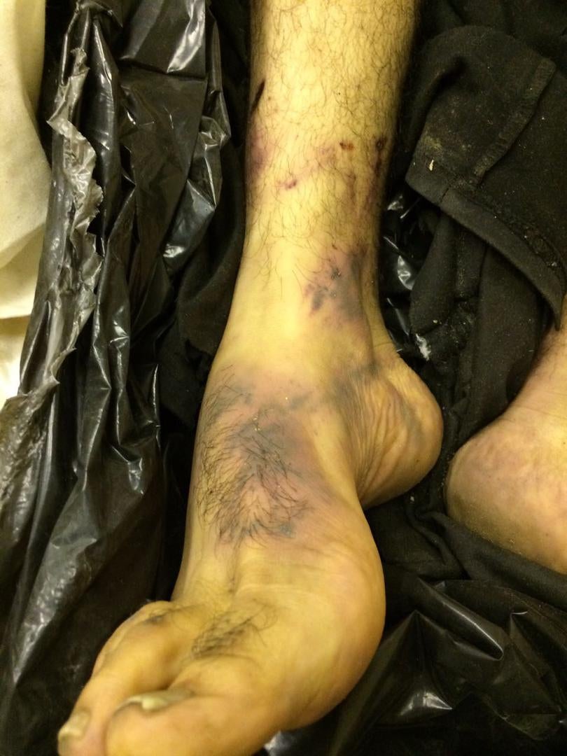 Photos of the bodies of three of the Syrians who died in military custody,