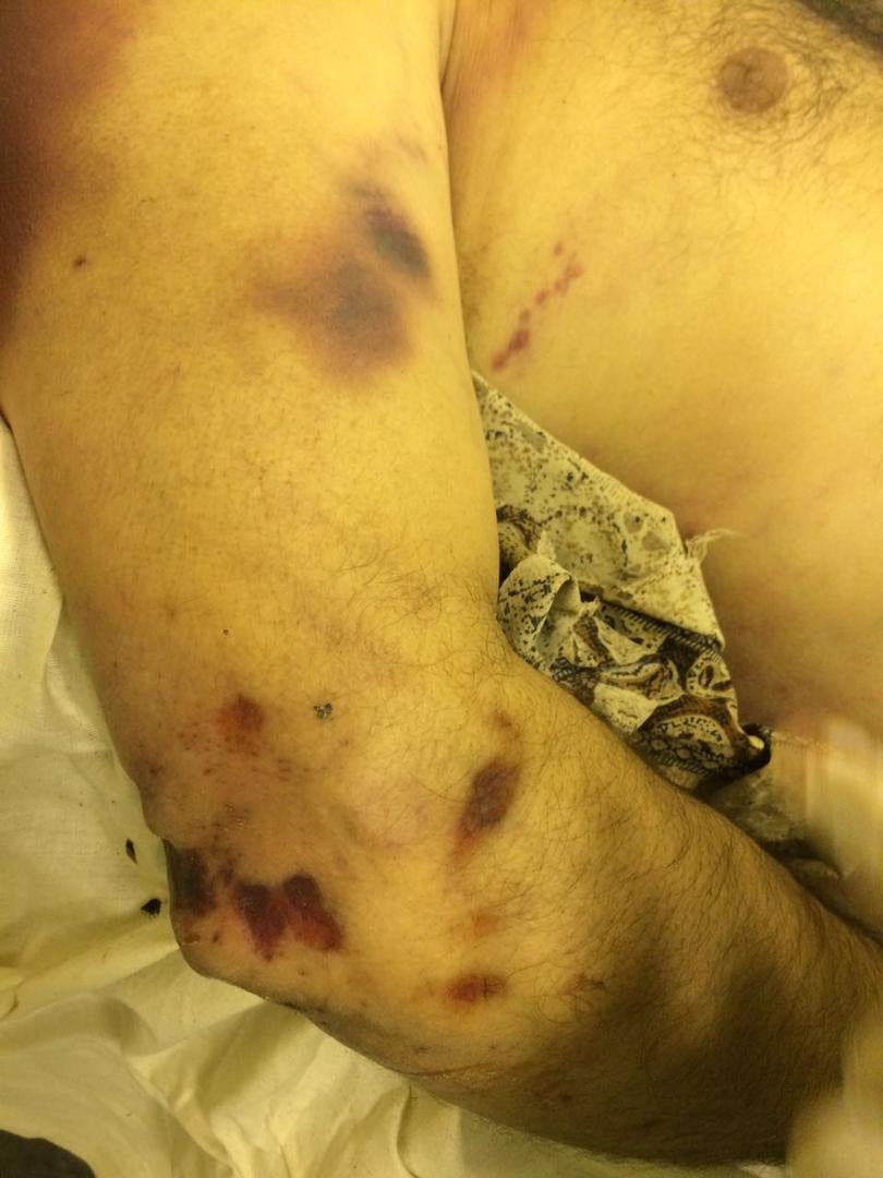 Photos of the bodies of three of the Syrians who died in military custody.