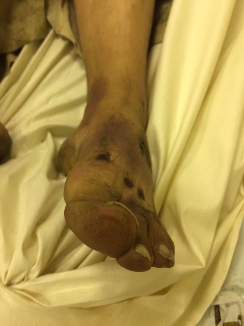 Photos of the bodies of three of the Syrians who died in military custody.