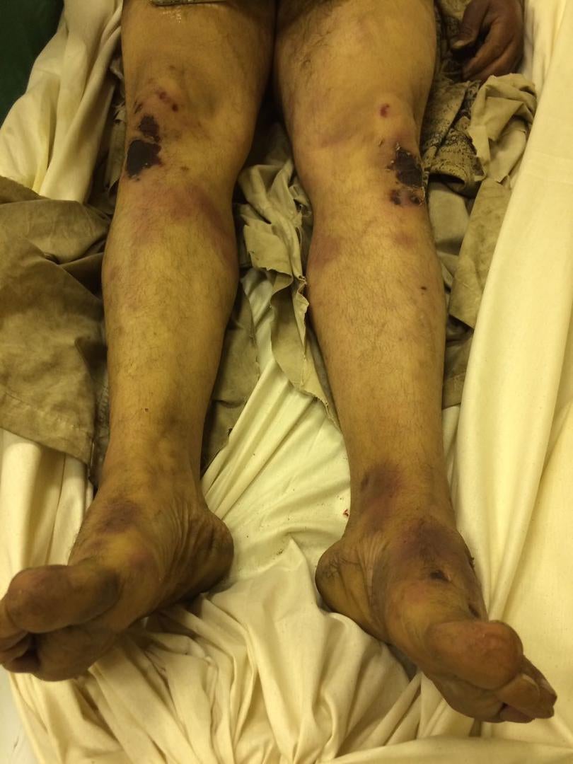 Photos of the bodies of three of the Syrians who died in military custody,