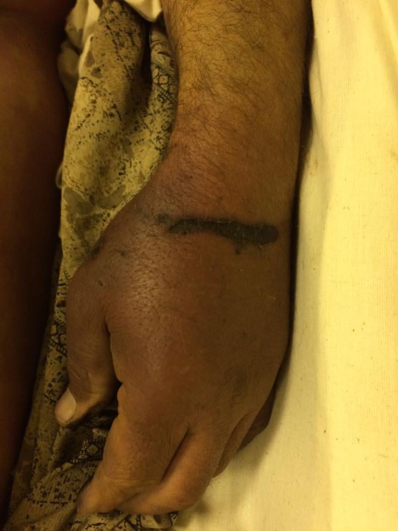 Photos of the bodies of three of the Syrians who died in military custody,