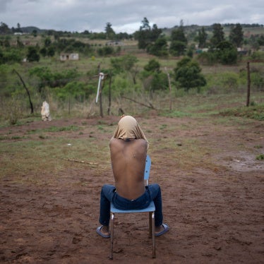 A boy shows a scar on his back allegedly from a rubber bullet 