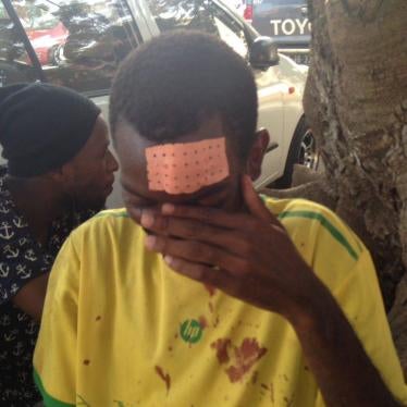 “Samussuku” Chiconda required stitches on his forehead after police officers beat him with batons, Luanda, February 24, 2017.